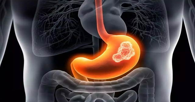 ۱
