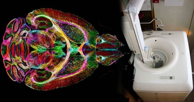 mri