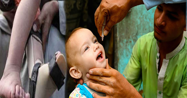 polio-virus polio-virus