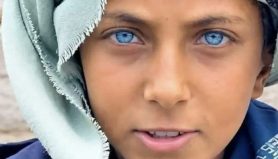 eyes
